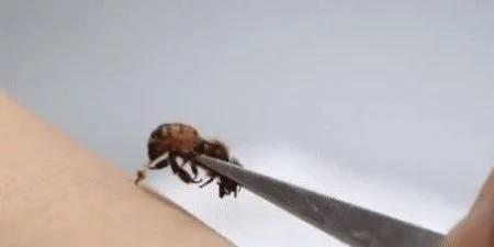 蝎子和蜜蜂哪个蜇人疼