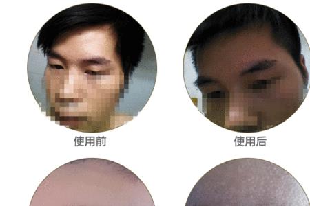 乌斯曼生眉液真的有用吗