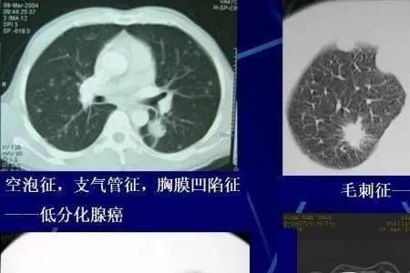 影像资料是什么意思