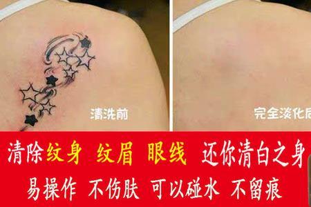 洗纹身需要什么证件