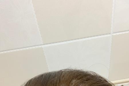 染浅棕色爆顶怎么办