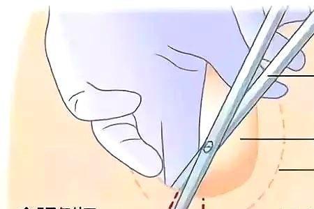 彻切什么意思