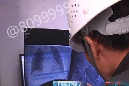 住院拍的片子可以报销吗