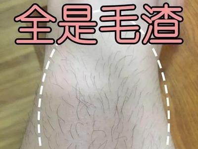 儿童可以剃腿毛吗