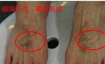 长寿毛可以拔吗
