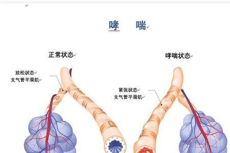 哮喘的读音是什么