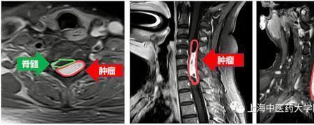目至是什么意思