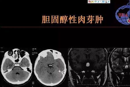 鞍区饱满是什么意思