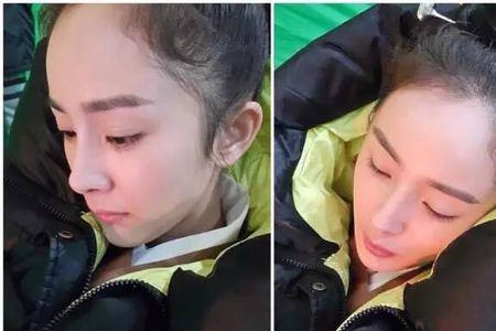 南方人为什么发际线高