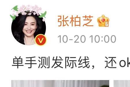 为什么自拍发际线好高