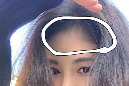 头发丝为什么能扎进肉里