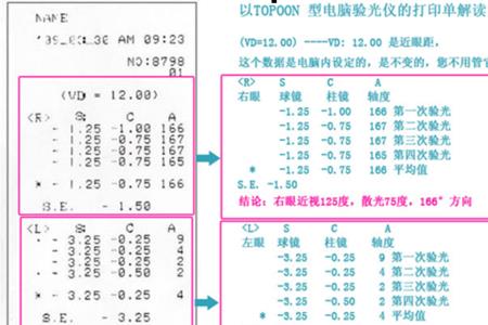 验光单上PL是什么意思