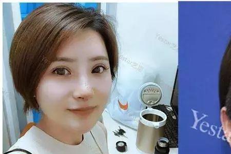 宁波艺星整鼻靠谱吗