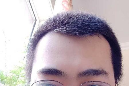 剃寸头之后为啥头发越来越少