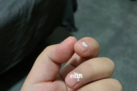 为啥有的女的手肉嘟嘟的