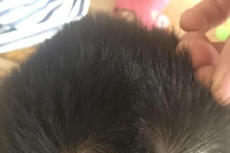 头发往哪边偏需要根据头旋吗