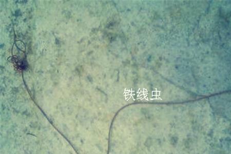 铁线虫怎么检查出来