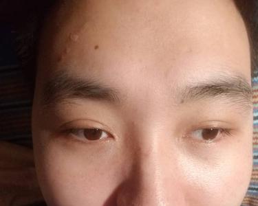 为什么照片眼睛不对称