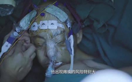 身体石化是啥意思