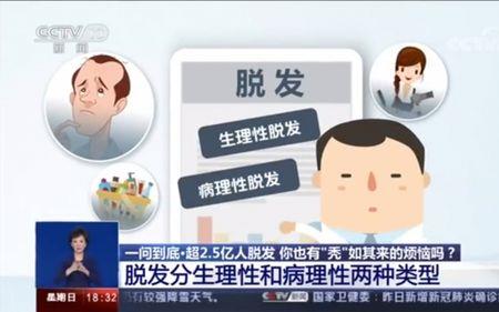 多少人的头发有一亿根
