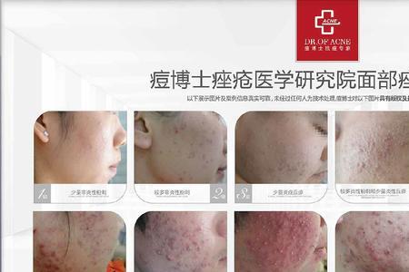 痘博士好还是蕾特恩好
