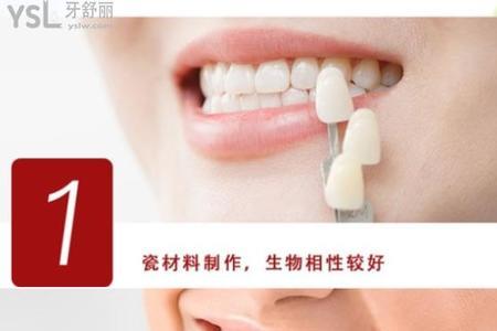 牙贴面有几款价位