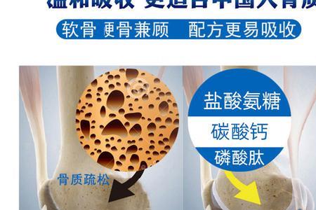 葡萄糖碳酸钙英文简写