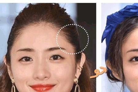 额头两侧的头发叫什么位置