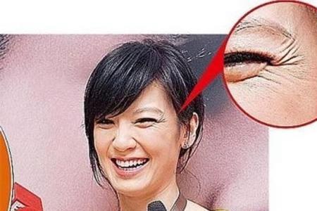 眼尾炸花和鱼尾纹的区别