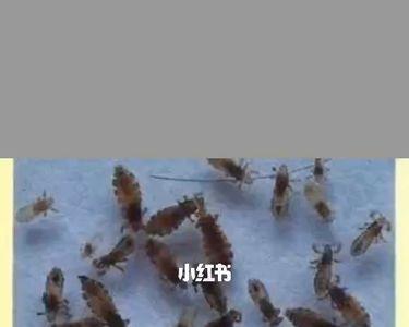 有阴虱被子怎么洗