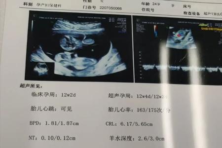 双绒双羊一大一小是怎么回事