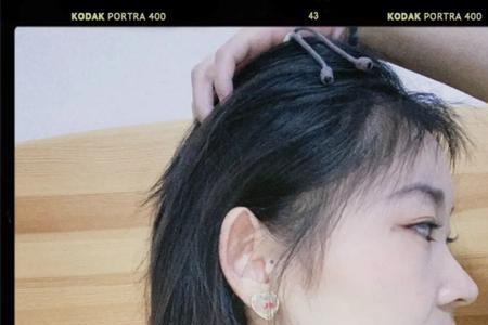 为什么正脸方侧脸不方