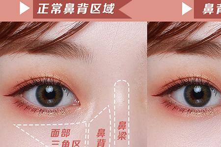 高鼻梁的原因