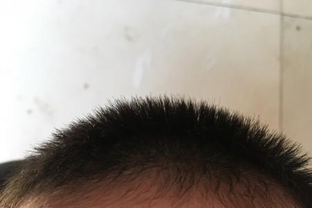 宝宝额头正常形状