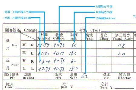 验光仪散光怎么调