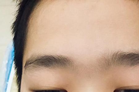 一岁半宝宝牙齿正常咬合的样子