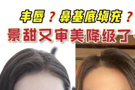 景甜脸为什么越来越大