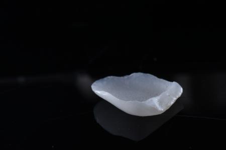 emax铸瓷贴面和琥珀那个好