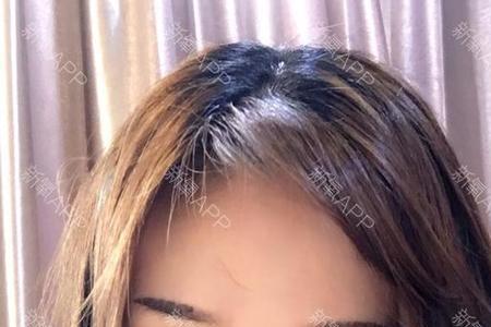 纹眉挑的有点高怎么补救