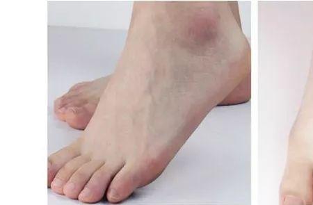 白脚丫怎么洗干净