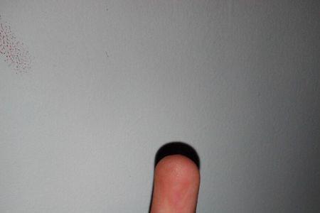 正常人的手指是什么样