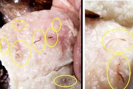 猪肉里的寄生虫会被冻死吗