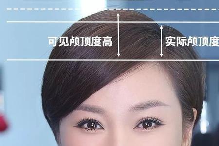 形容发际线高的成语