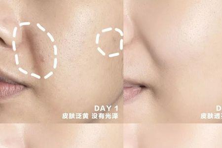 暗沉是什么意思