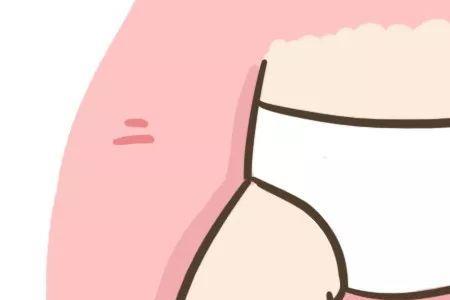 正常新生儿有几条腿纹