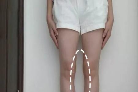 女人腿缝宽怎么回事