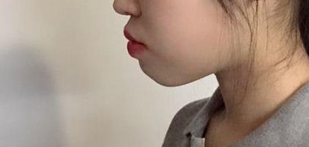 脑袋前凸后凸的孩子聪明吗