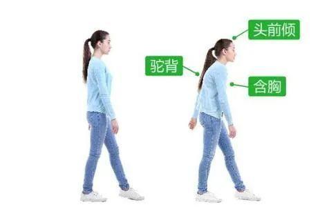 走路姿势多久可以改正