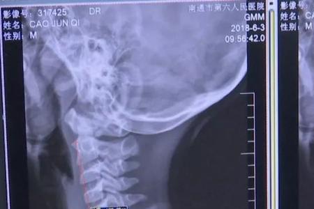 弧度多少才算反弓