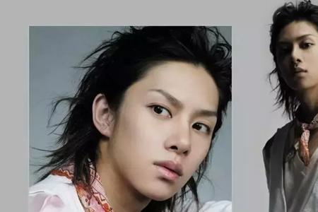 男性偏女性化叫什么